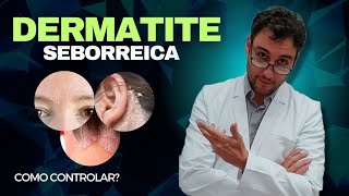 Como controlar a Dermatite Seborreica [upl. by Kimmy]