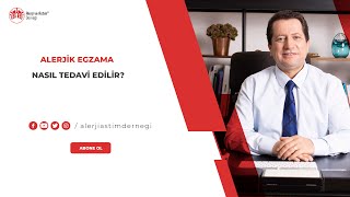 Alerjik egzama nasıl tedavi edilir [upl. by Joelynn]