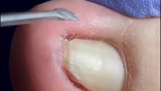 The Ultimate Guide to Perfectly Cut and Clean Nailscutting nail [upl. by Funch17]