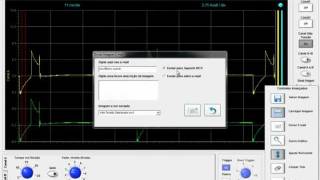 WCV Scope 3 [upl. by Vanhomrigh]