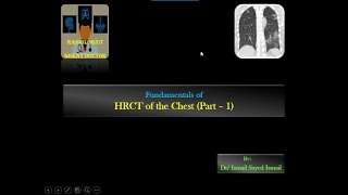 HRCT chest for Radiology Residents  Part 1  Technique [upl. by Ociredef]