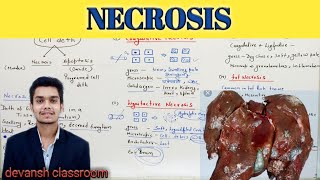 NECROSIS  cell injury  general Pathology Hindi [upl. by Langham]