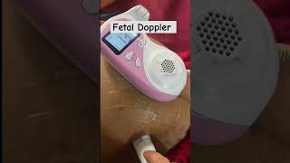 Fetal Doppler babyvideobaby [upl. by Pearlman877]