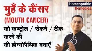 मुँह का कैंसर  Mouth Cancer  Natural homeopathic remedies with symptoms [upl. by Neelrac]