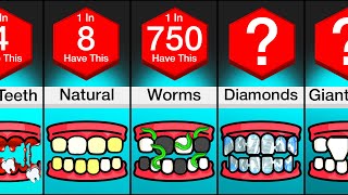 Comparison Different Types Of Teeth [upl. by Ahsiyt]