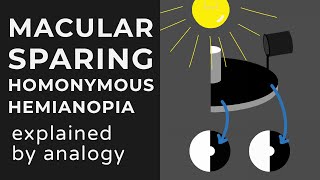 Macular Sparing amp Splitting Homonymous Hemianopia  Animation  Explained Conceptually [upl. by Gwenora]