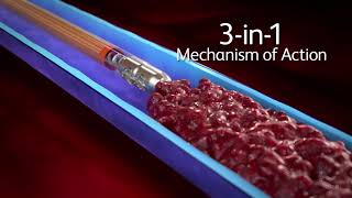 Aspirex™ Thrombectomy System 3in1 Mechanism of Action [upl. by Tymothy]