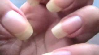 Nail Magic ReviewPart 1amp2 Best nail hardener ever [upl. by Un]