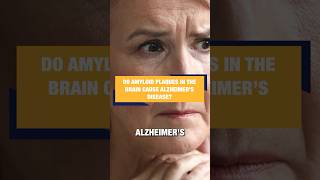 Do Amyloid Plaques in the Brain Cause Alzheimer’s Disease [upl. by Heather]