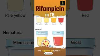 What is Rifampicin  Rifampicin in TB rifampicin nursing testpaperlivenursing shortvideo aiims [upl. by Avra240]