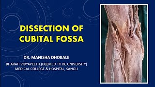 Dissection of Cubital Fossa Boundaries contents Applied Anatomy Everything that you need to know [upl. by Marciano]