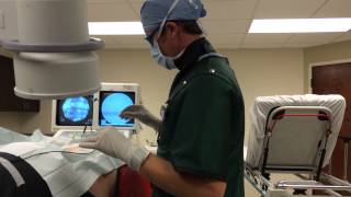 Dr McRoberts performs a Facet Joint Nerve Ablation in Real Time With a Real Patient [upl. by Amleht]