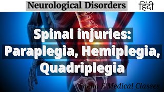 Spinal injuries Paraplegia Hemiplegia Quadriplegia  Hindi [upl. by Acima]