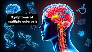 Multiple sclerosis signs and symptoms explained [upl. by Eilra878]