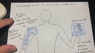 Traumatología Fracturas y complicaciones Esquema 23 [upl. by Goodhen901]