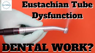 Eustachian Tube Dysfunction and Needing Dental Work The Root Cause Personal Experience [upl. by Derick]