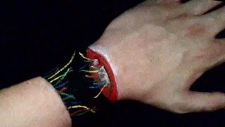 Disconnected Hand  Illusion Trick Art [upl. by Matthew]