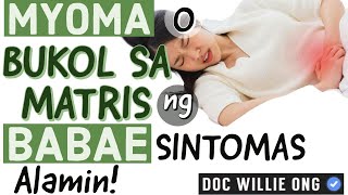 Bukol sa Matris o Myoma  Payo ni Doc Willie Ong 1c [upl. by Fayre]