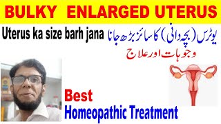 bulky uterus treatment in urdu hindiBacha dani ka size badrhnabulky uterus ka ilaj homeopathic [upl. by Betti]