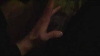 Mild hypokalemic periodic paralysis attack hand 20100113211503mpg [upl. by Shaddock905]