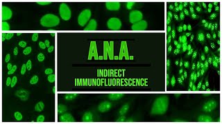 ANA  Antinuclear Antibody  IIF  SLE  Sjogren  RA  CREST [upl. by Yeh620]