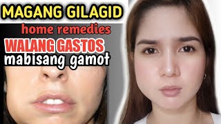 PAANO MAWALA ANG NAMAMAGANG GUMS o GILAGID  easy home remedies [upl. by Heyes]