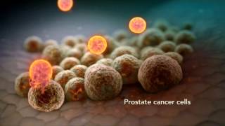 Advanced Prostate Cancer Living Longer Living Better [upl. by Penoyer]