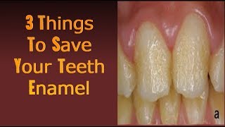 3 Critical Tips That Will Save Your Tooth Enamel Right Away [upl. by Yenalem363]