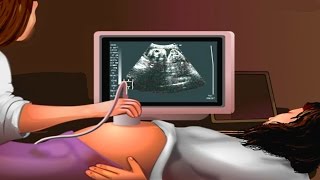 How Ultrasound Works Animation  Ultrasound Scan During Pregnancy Video  USG Medical Imaging [upl. by Bevus]