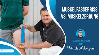 Muskelfasserriss VS Muskelzerrung – Wie Du es erkennst und unterscheiden kannst [upl. by Lasala]