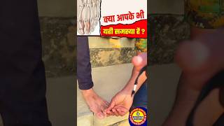 ssc gd leg medical test  पैर की उंगली चोटी  army leg medical test shortsfeed sscgdmedical viral [upl. by Drawde378]