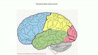 Acute Traumatic Brain Injury  Adventures in Neuropathology [upl. by Alle]