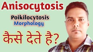 Anisocytosis in hindi  Poikilocytosis in hindi  Anisopoikilocytosis in hindi  RBC morphology [upl. by Yecad]