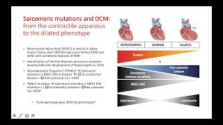 Dilated Cardiomyopathy from genetics to novel treatment approaches [upl. by Nyrret]