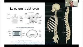 SPINE WEBINAR 61 PROCESO DEGENERATIVO VERTEBRAL ENVEJECIMIENTO Y OSTEOPOROSIS [upl. by Marcela]