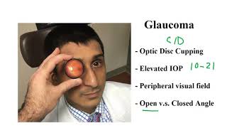 USMLE ACE Video 218 Glaucoma Optic Disc Changes Intraocular Pressure and Angle Classification [upl. by Rocco]