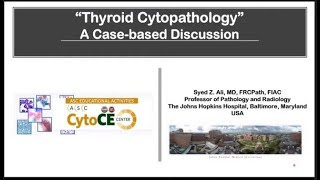 Thyroid Cytopathology [upl. by Udella]