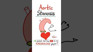 Aortic Stenosis AS  Valvular Heart Disease VHDscience doctor nurse cardio mbbs nclex [upl. by Cowden85]