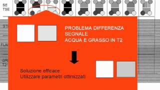 Semeiotica del segnale in risonanza magnetica 37 [upl. by Stevana]