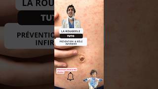 Comprendre et Prévenir la Rougeole  Guide pour les Infirmiers ide tutorial nurse measles tips [upl. by Cookie]