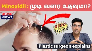 முடி வளர்ச்சிக்கு மினாக்ஸிடில் எப்படி பயன்படுத்துவது Minoxidil  Hair Loss clinic coimbatore [upl. by Creigh432]