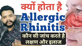 Allergic Rhinitis Causes Symptoms Prevention amp Treatment In Hindi  Gyanear [upl. by Mychael]