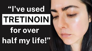 My 22YEAR Tretinoin Experience The Key to Youthful Skin for Over 2 Decades [upl. by Amorita]