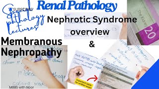 membranous nephropathy  nephrotic syndrome  renal pathology lectures  selflessmedicose [upl. by Eiltan]