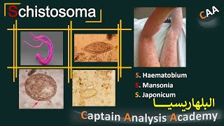 E10 Schistosoma 🔥 البلهاريسيا بانواعها وطرق تشخيصها بالمعمل وعلاقتها بحمى التيفويد 🔥 [upl. by Wood691]