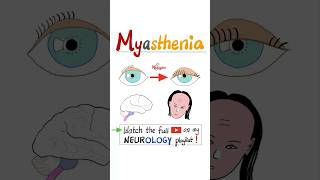 Myasthenia Gravis MG  Muscle Weakness Fatigue…science anatomy pathology health nurse mbbs [upl. by Jonina]