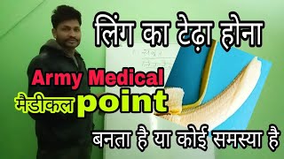 क्या टेढ़ा होना पर मिलेगा army medical point \ Army running tips [upl. by Olleina901]