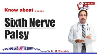 Sixth Nerve Palsy  Causes Diagnosis Symptoms Treatment Prognosis [upl. by Saideman]