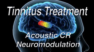 Tinnitus Treatment Using Acoustic Coordinated Reset Neuromodulation ACRN [upl. by Zwiebel]