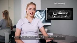 Sudėtingas endodontinio gydymo atvejis neįprasti kanalai ir sėkmingi rezultatai  Austėja Kalkienė [upl. by Licht]